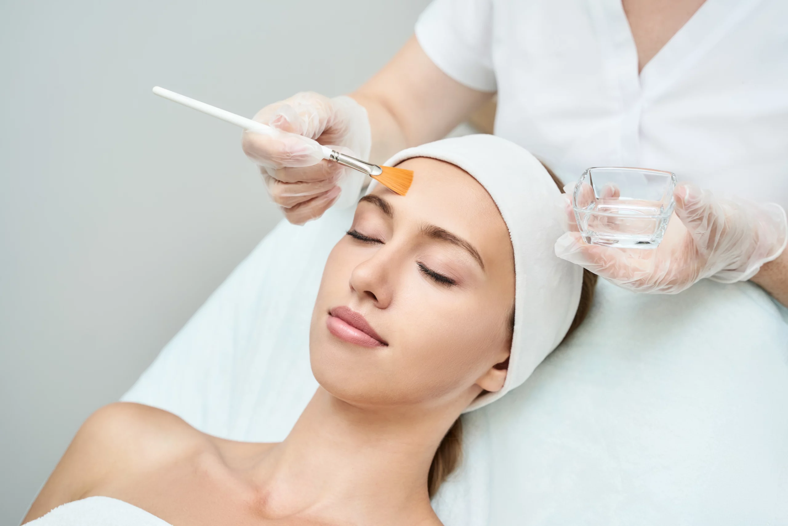 chemical-peels-campman by-360Envy-Aesthetics-WellnessIN-REISTERSTOWN