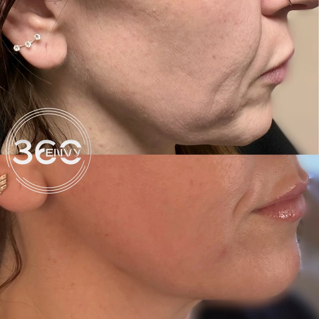 result-a-quenchinfusions by-360Envy-Aesthetics-WellnessIN-REISTERSTOWN